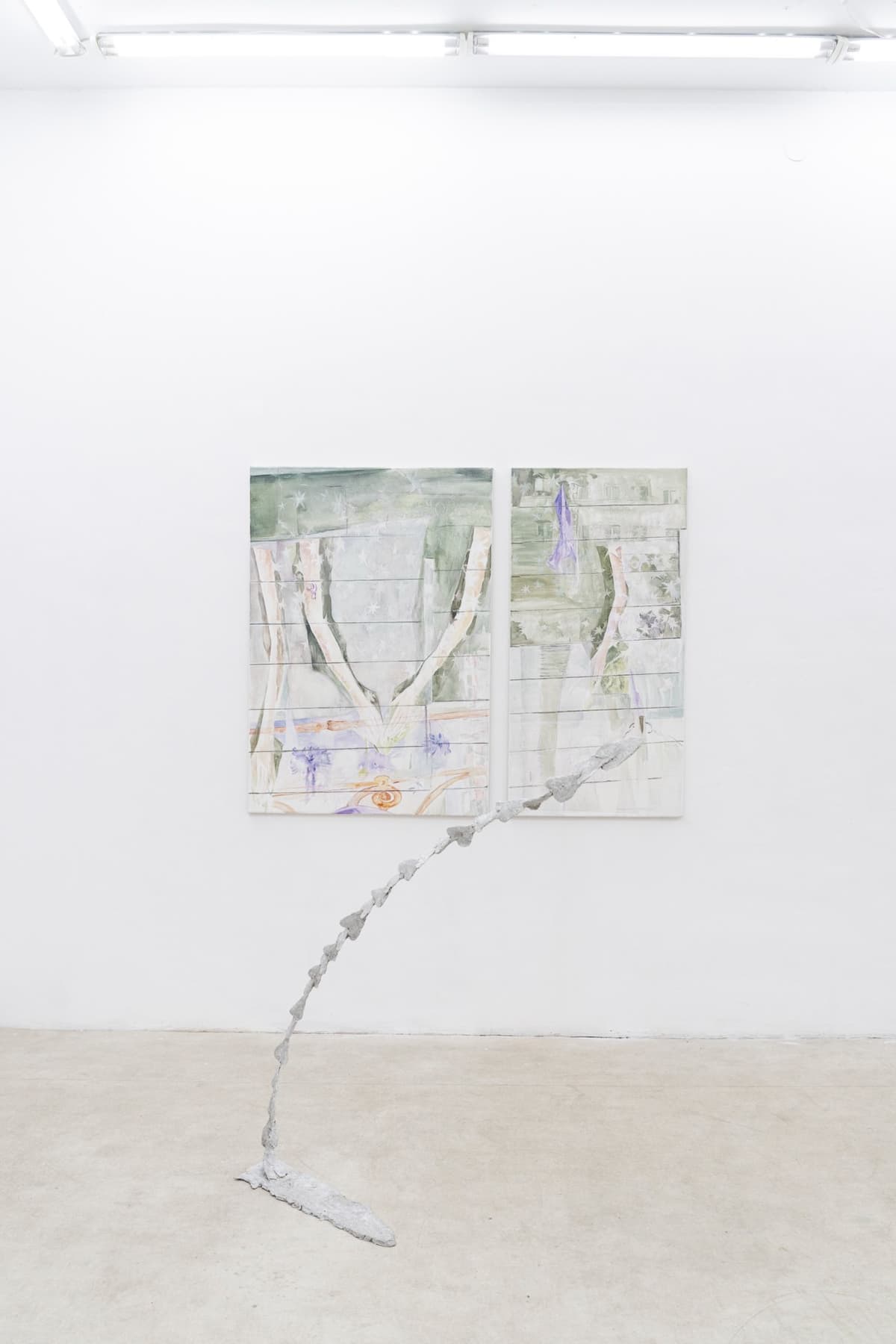 The Shape of a Scar installation view 7