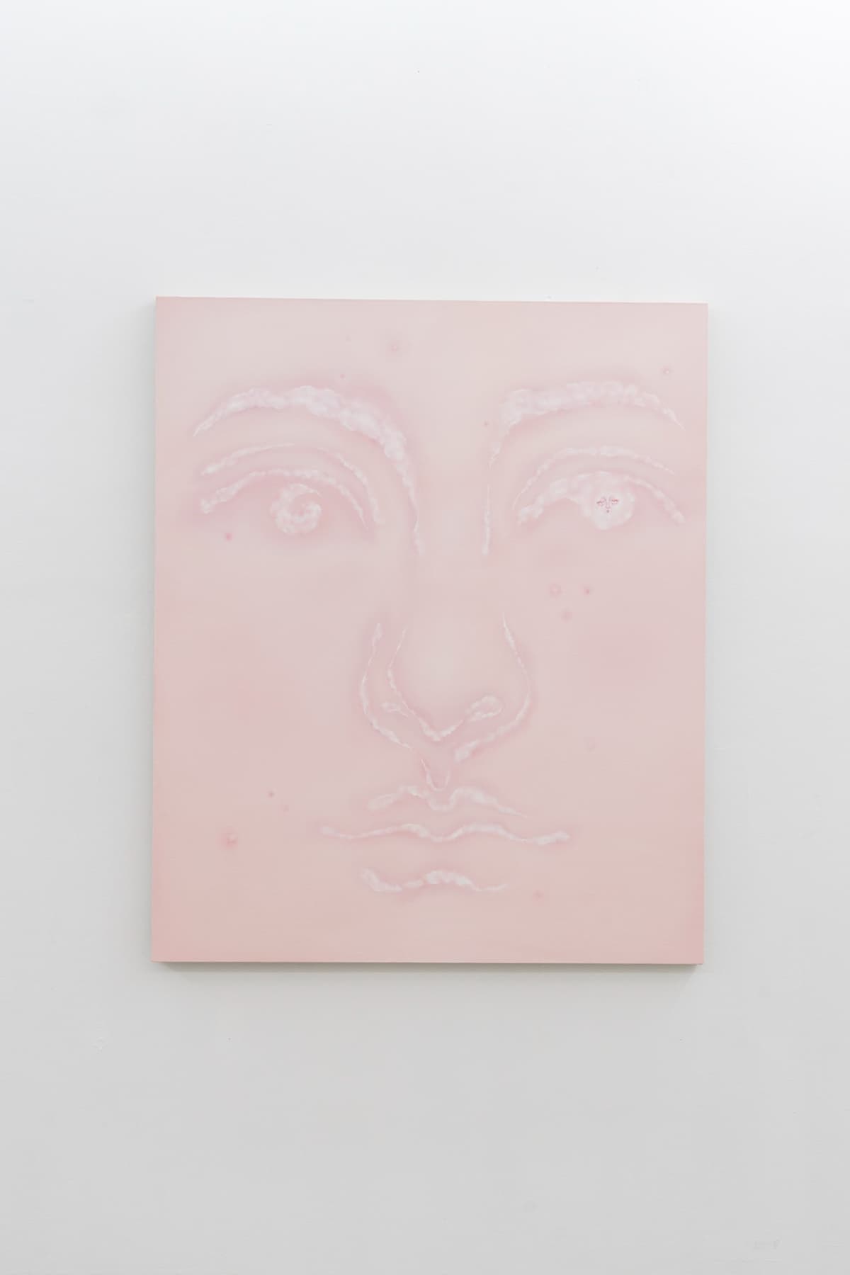 The Shape of a Scar installation view 14
