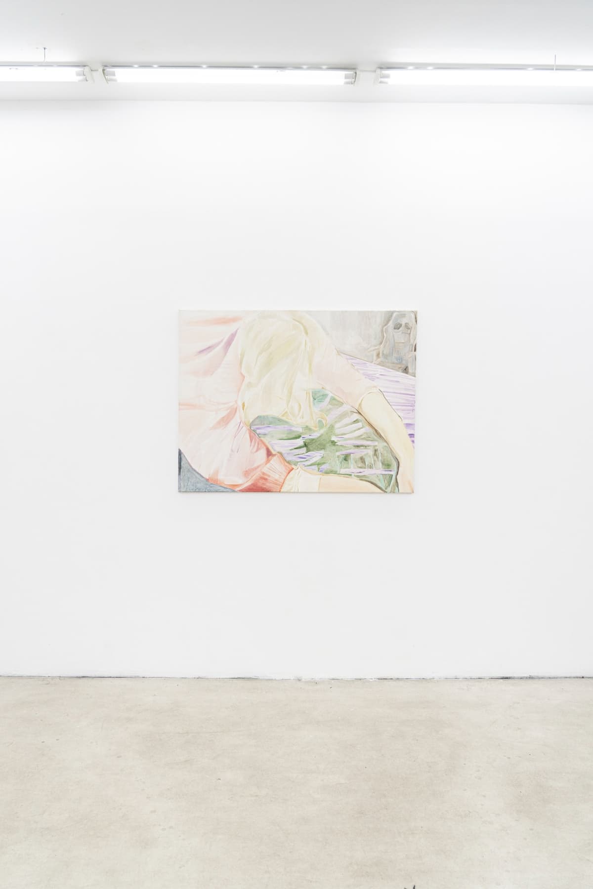 The Shape of a Scar installation view 20