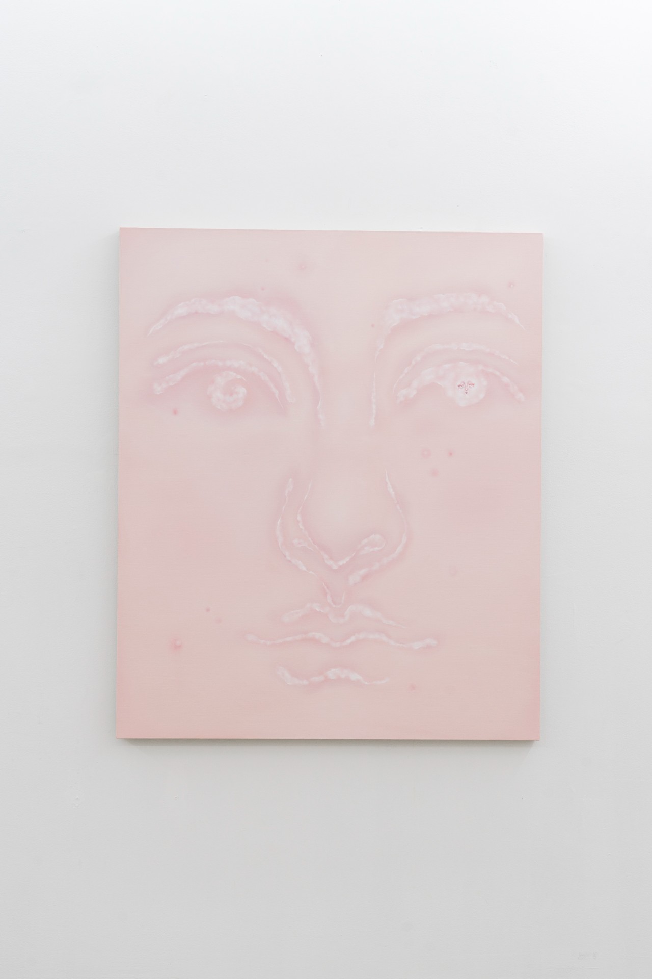 The Shape of a Scar installation view 14